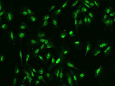 Immunocytochemistry/ Immunofluorescence: DDX46 Antibody [NBP2-98581]