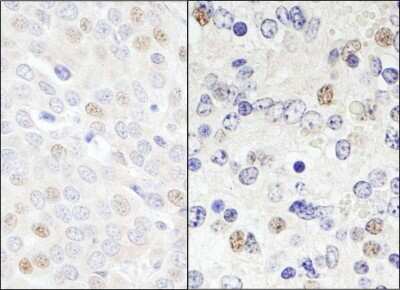 Immunohistochemistry-Paraffin: DDX46 Antibody [NB100-57489]