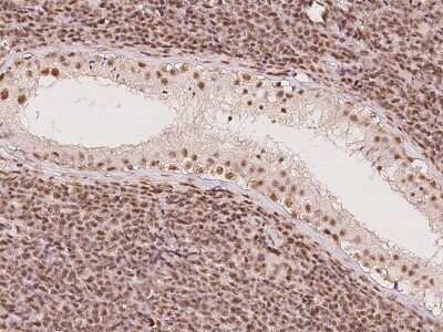 Immunohistochemistry-Paraffin: DDX46 Antibody [NBP2-98581]