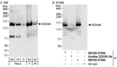 Western Blot: DDX46 Antibody [NB100-57490]