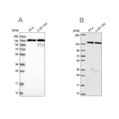 Western Blot: DDX46 Antibody [NBP1-83565]