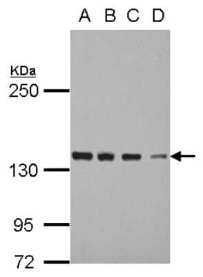 Western Blot: DDX46 Antibody [NBP2-16138]