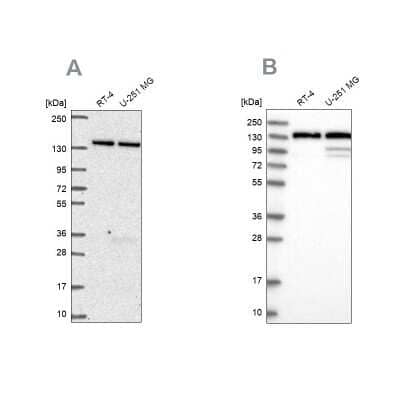 Western Blot: DDX46 Antibody [NBP2-56227]