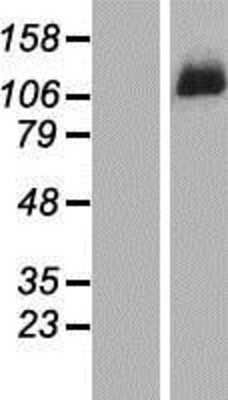 Western Blot: DDX46 Overexpression Lysate [NBP2-07275]