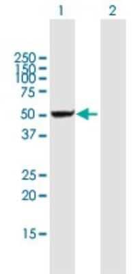 Western Blot: DDX47 Antibody [H00051202-B01P]