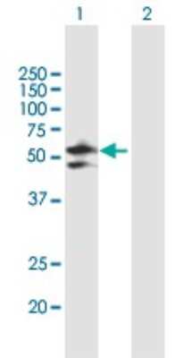 Western Blot: DDX47 Antibody [H00051202-B02P]