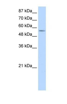 Western Blot: DDX47 Antibody [NBP1-57295]