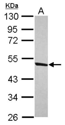 Western Blot: DDX47 Antibody [NBP2-16139]