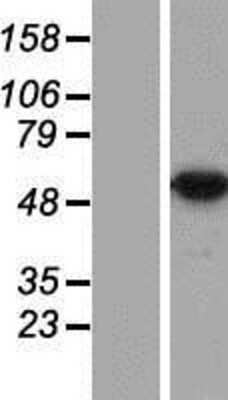 Western Blot: DDX47 Overexpression Lysate [NBP2-07049]