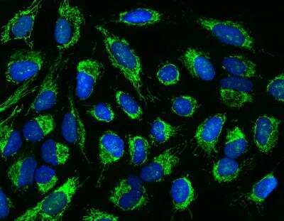 Immunocytochemistry/ Immunofluorescence: DDX49 Antibody [NBP3-12553]