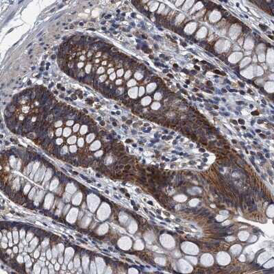 Immunohistochemistry-Paraffin: DDX49 Antibody [NBP2-48749]