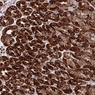 Immunohistochemistry-Paraffin: DDX49 Antibody [NBP2-47491]