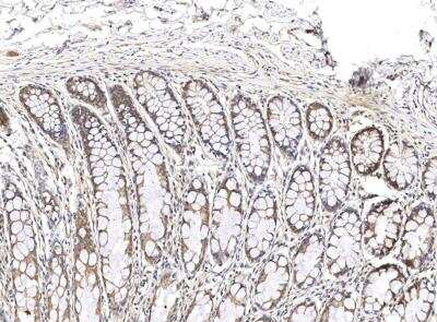 Immunohistochemistry-Paraffin: DDX49 Antibody [NBP3-12553]
