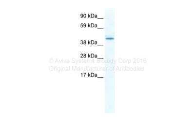 Western Blot: DDX49 Antibody [NBP1-69713]