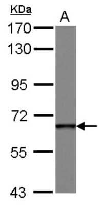 Western Blot: DDX49 Antibody [NBP2-16140]