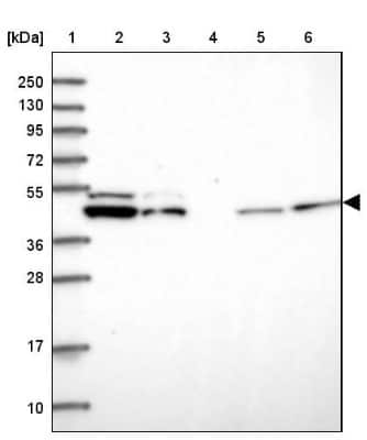 Western Blot: DDX49 Antibody [NBP2-47491]