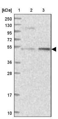 Western Blot: DDX49 Antibody [NBP2-48749]