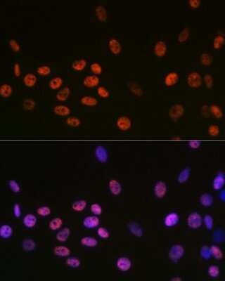 Immunocytochemistry/ Immunofluorescence: DDX5 Antibody (1K6X10) [NBP3-15371]
