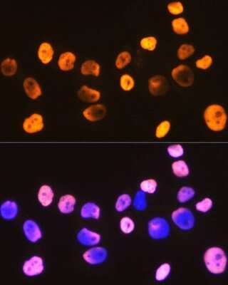 Immunocytochemistry/ Immunofluorescence: DDX5 Antibody (1K6X10) [NBP3-15371]