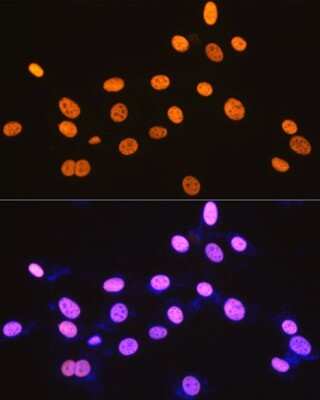 Immunocytochemistry/ Immunofluorescence: DDX5 Antibody (1K6X10) [NBP3-15371]