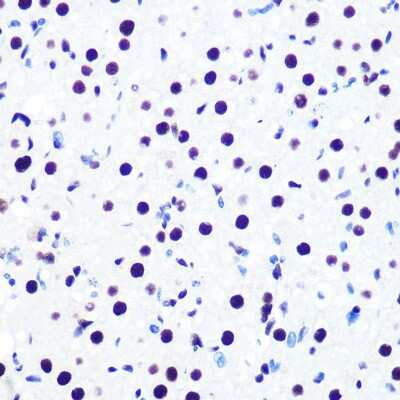 Immunohistochemistry-Paraffin: DDX5 Antibody (1K6X10) [NBP3-15371]