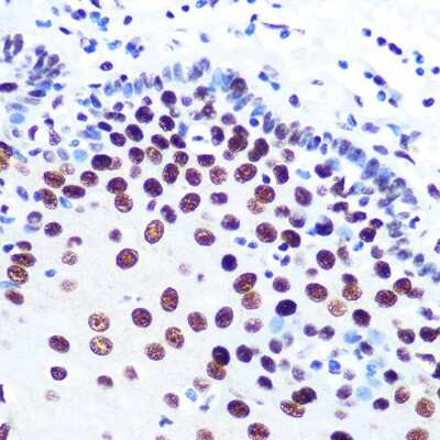 Immunohistochemistry-Paraffin: DDX5 Antibody (1K6X10) [NBP3-15371]