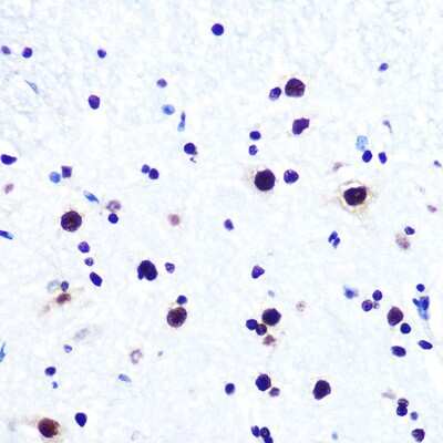 Immunohistochemistry-Paraffin: DDX5 Antibody (1K6X10) [NBP3-15371]