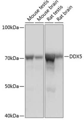 Western Blot: DDX5 Antibody (1K6X10) [NBP3-15371]