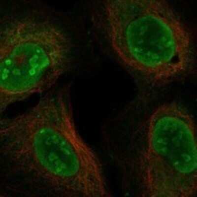 Immunocytochemistry/ Immunofluorescence: DDX5 Antibody [NBP3-17654]