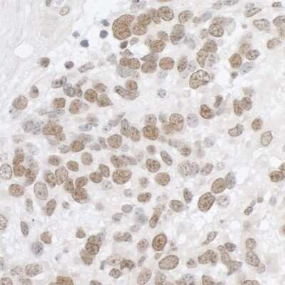 Immunohistochemistry: DDX5 Antibody [NB200-351]