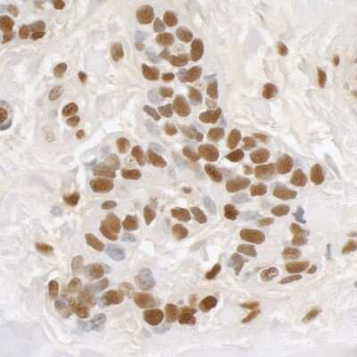 Immunohistochemistry: DDX5 Antibody [NB200-351]