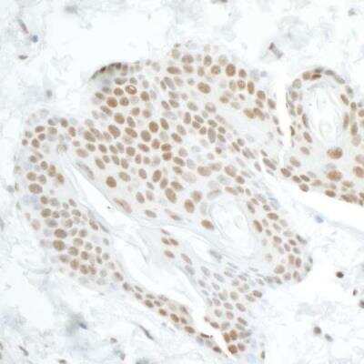 Immunohistochemistry: DDX5 Antibody [NB200-351]