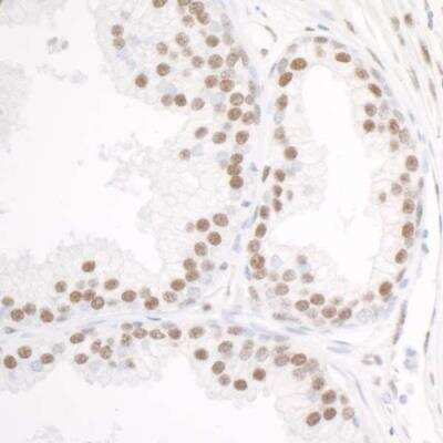 Immunohistochemistry: DDX5 Antibody [NB200-351]