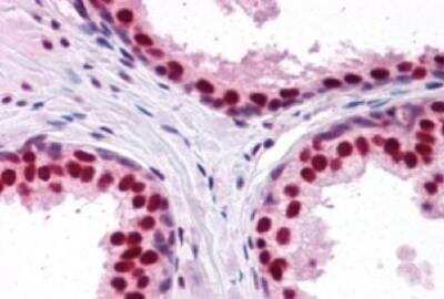 Immunohistochemistry-Paraffin: DDX5 Antibody [NB100-1410]
