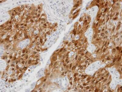 Immunohistochemistry-Paraffin: DDX5 Antibody [NBP1-30944]
