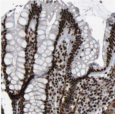 Immunohistochemistry-Paraffin: DDX5 Antibody [NBP1-83406]