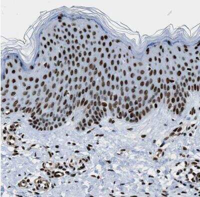 Immunohistochemistry-Paraffin: DDX5 Antibody [NBP1-83406]