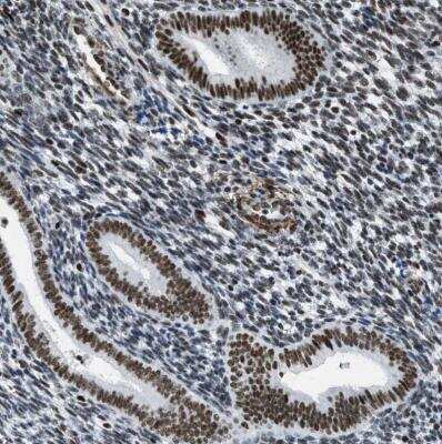 Immunohistochemistry-Paraffin: DDX5 Antibody [NBP1-83406]