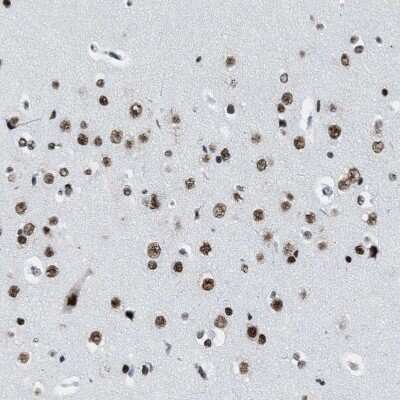 Immunohistochemistry-Paraffin: DDX5 Antibody [NBP1-83406]