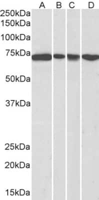 Western Blot: DDX5 Antibody [NB100-1410]