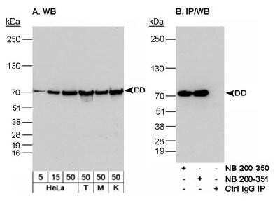 Western Blot: DDX5 Antibody [NB200-351]