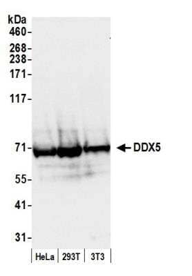 Western Blot: DDX5 Antibody [NB200-351]