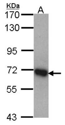 Western Blot: DDX5 Antibody [NBP1-30944]