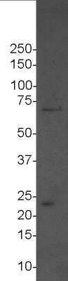 Western Blot: DDX5 Antibody [NBP1-30944]