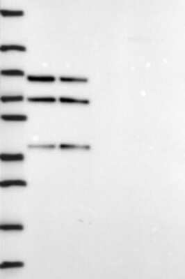 Western Blot: DDX5 Antibody [NBP3-17654]