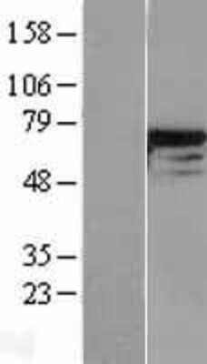 Western Blot: DDX5 Overexpression Lysate [NBL1-09801]