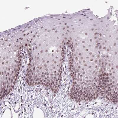 Immunohistochemistry-Paraffin: DDX50 Antibody [NBP2-55077]