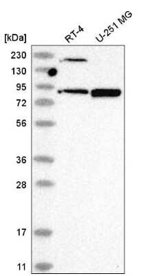 Western Blot: DDX50 Antibody [NBP2-58135]