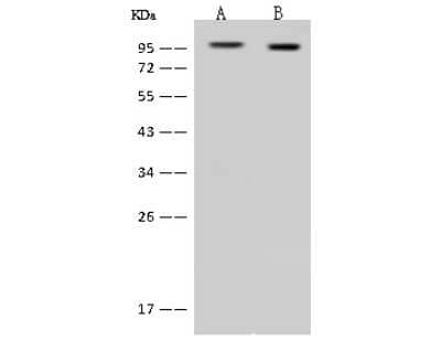 Western Blot: DDX50 Antibody [NBP2-97538]