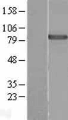 Western Blot: DDX50 Overexpression Lysate [NBL1-09802]